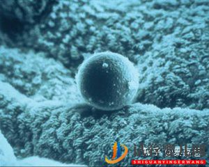 論決定三代試管成功率5大因素之子宮內膜(圖4)