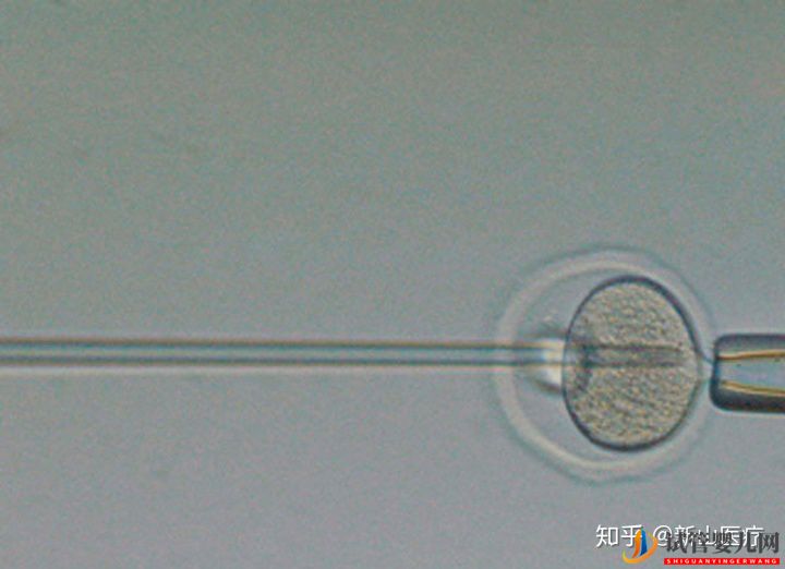 試管嬰兒幾代好一代、二代、三代先辨別清楚(圖1)