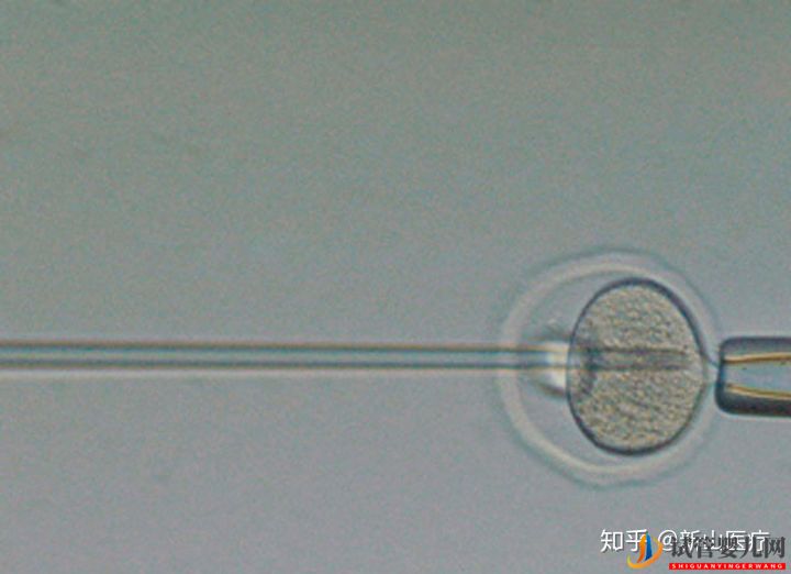 試管嬰兒幾代好一代、二代、三代先辨別清楚(圖2)