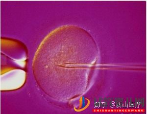 試管嬰兒幾代好一代、二代、三代先辨別清楚(圖6)