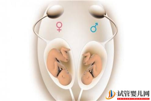 試管嬰兒網:試管嬰兒懷雙胞胎幾率高嗎(圖1) 試管嬰兒懷雙胞胎幾率高嗎(圖1)