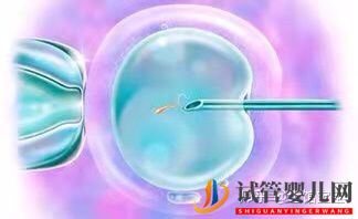 很多人說(shuō)試管嬰兒可能不會(huì)是自己親生的(圖2)