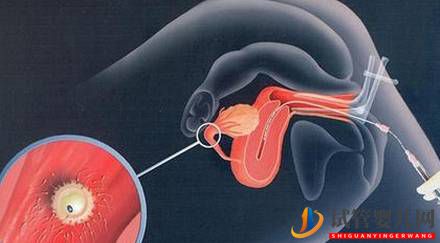 人工授精和人工受孕是一回事兒么？可能多數人理解錯了，了解下！(圖1)