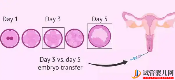 試管嬰兒在交通事故十日后流產(chǎn),損失怎么賠(圖1)