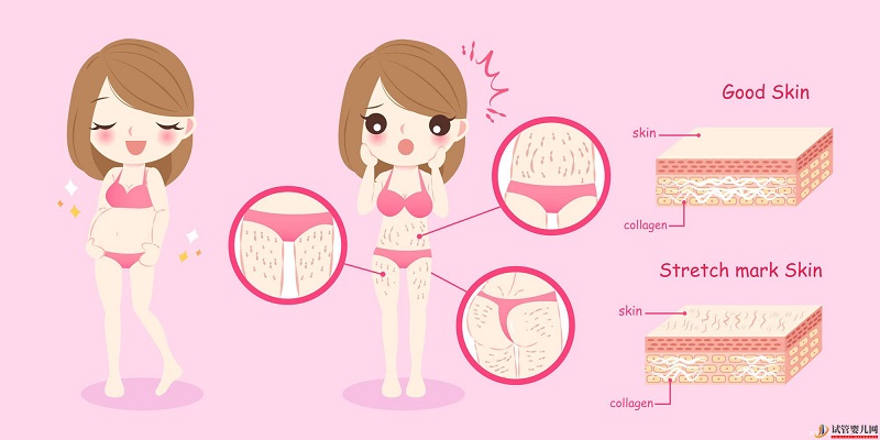 西藏1家試管嬰兒醫院排名、成功率與費用是否醫保報銷？(圖2)