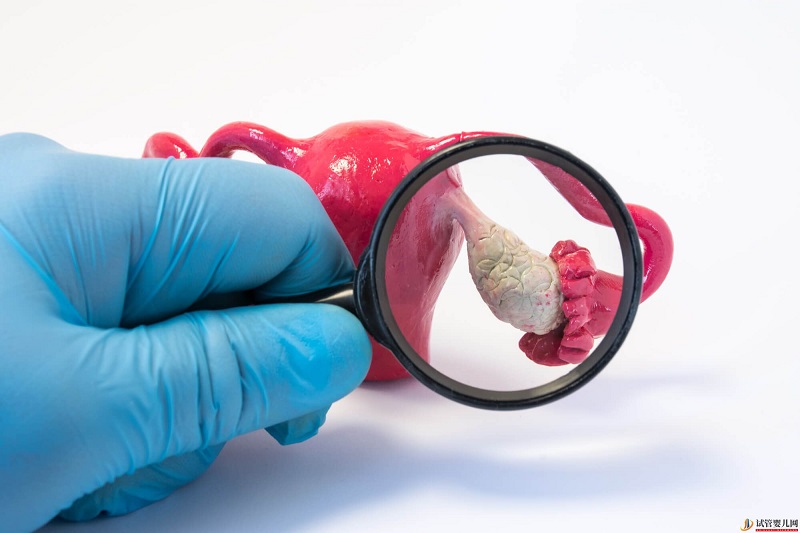 重慶11家試管嬰兒醫院排名、成功率與費用是否醫保報銷？(圖3)