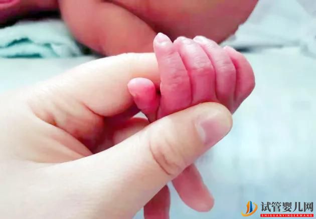 試管嬰兒雙胞胎龍鳳胎的概率(圖1)