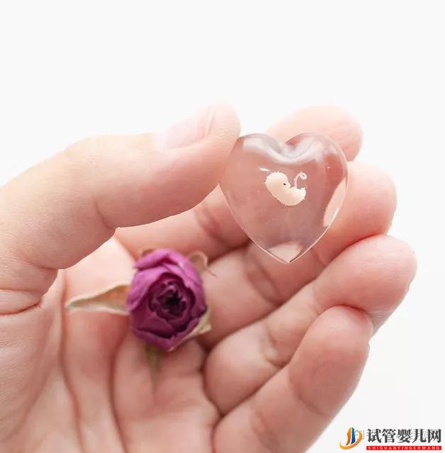 美國試管可以做雙胞胎嗎風險大不大(圖3)