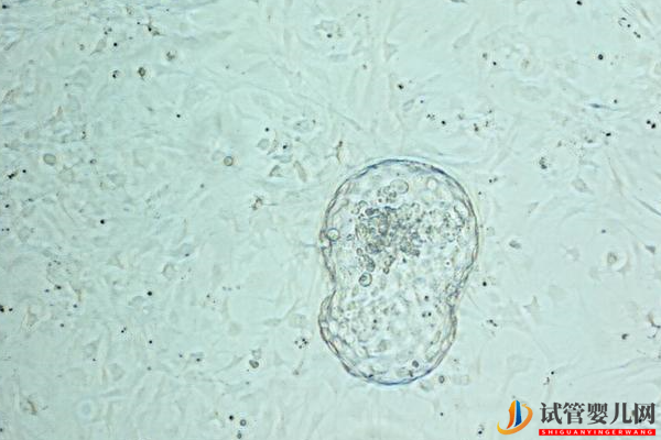 美國試管嬰兒單胎移植：為什么成功率依然很高？(圖1)