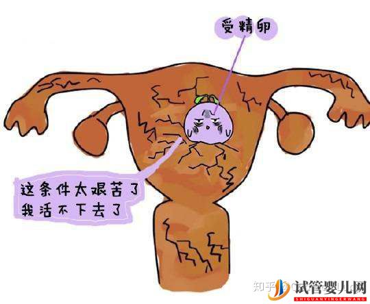 做泰國試管嬰兒要滿足哪些條件(圖2) 做泰國試管嬰兒要滿足哪些條件(圖2)