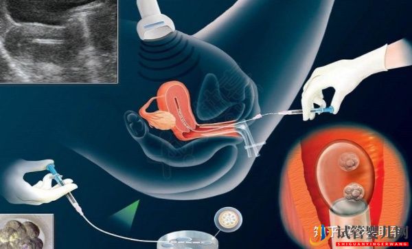 教你自測美國試管嬰兒成功率(試管嬰兒多少錢)(圖12) 教你自測美國試管嬰兒成功率(圖6)