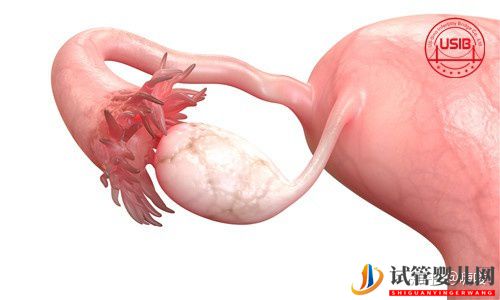 新手媽媽做美國(guó)試管嬰兒前一定要了解這些知識(shí)!(試管嬰兒多少錢(qián))(圖1) 新手媽媽做美國(guó)試管嬰兒前一定要了解這些知識(shí)!(圖1)