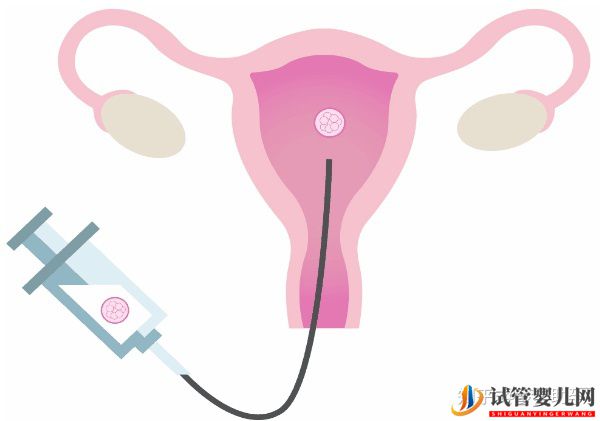 38歲高齡女性赴美試管成功率是多少-夢(mèng)美(試管嬰兒多少錢)(圖16) 38歲高齡女性赴美試管成功率是多少(圖8)