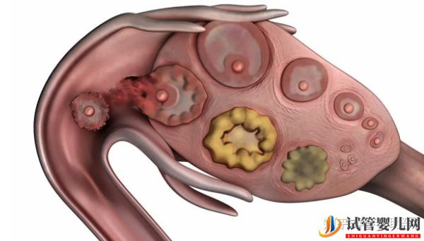 多次試管失敗,赴美試管成功率如何-夢(mèng)美(試管嬰兒多少錢)(圖6) 多次試管失敗,赴美試管成功率如何(圖3)