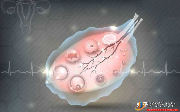 多次試管失敗,赴美試管成功率如何-夢(mèng)美(試管嬰兒多少錢)(圖12) 多次試管失敗,赴美試管成功率如何(圖6)