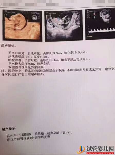 泰國試管嬰兒心路歷程(圖4) 泰國試管嬰兒心路歷程(圖4)