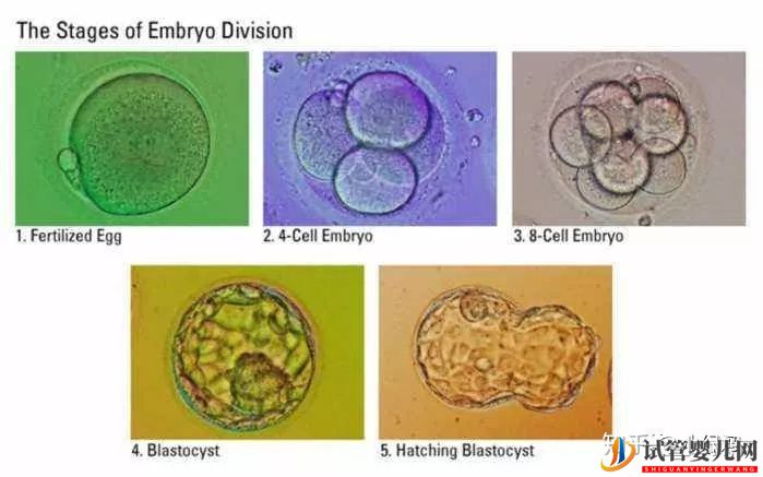 囊胚級別劃分,什么級別的囊胚成功率最高(圖7)