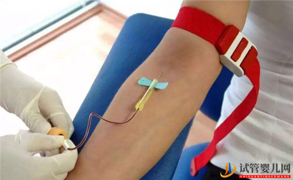 女性試管嬰兒前哪些抽血檢查項(xiàng)目需要空腹最佳抽血時(shí)間為多少(圖1)