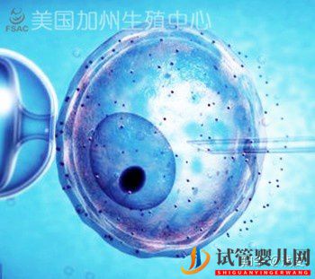 FSAC美國試管嬰兒影響成功率的因素(圖1)