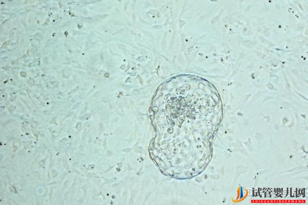 去美國做試管嬰兒,兩步走輕松實現生雙胞胎(圖2)