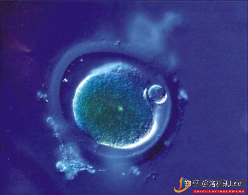 美國(guó)試管助孕可以挑選性別嗎(試管嬰兒多少錢)(圖2) 美國(guó)試管助孕可以挑選性別嗎(圖2)