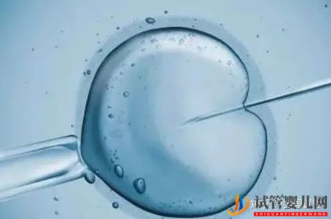 美國試管嬰兒中的取卵手術是如何操作的(圖1)