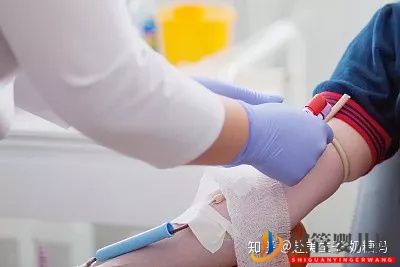 美國試管嬰兒各環節時間安排,整個流程需要多少天(圖2)