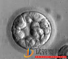 美國(guó)試管嬰兒這樣的囊胚才是極好的!(試管嬰兒多少錢(qián))(圖11) 美國(guó)試管嬰兒這樣的囊胚才是極好的!(圖6)