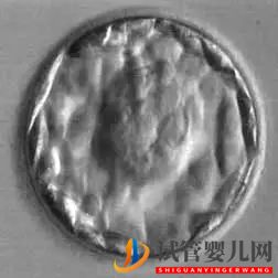 美國(guó)試管嬰兒這樣的囊胚才是極好的!(試管嬰兒多少錢(qián))(圖19) 美國(guó)試管嬰兒這樣的囊胚才是極好的!(圖10)