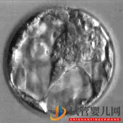 美國(guó)試管嬰兒這樣的囊胚才是極好的!(試管嬰兒多少錢(qián))(圖23) 美國(guó)試管嬰兒這樣的囊胚才是極好的!(圖12)