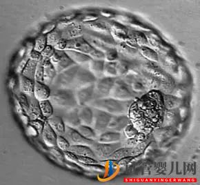 美國(guó)試管嬰兒這樣的囊胚才是極好的!(試管嬰兒多少錢(qián))(圖27) 美國(guó)試管嬰兒這樣的囊胚才是極好的!(圖14)