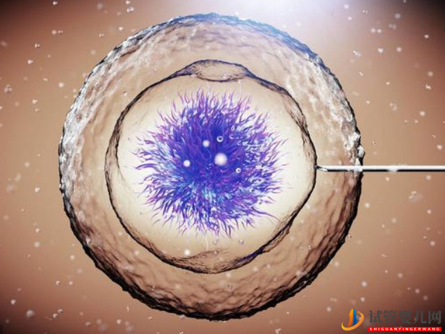 臺(tái)灣能做三代試管龍鳳胎嗎?(圖1) 臺(tái)灣能做三代試管龍鳳胎嗎?(圖1)