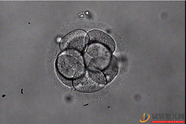 和田21個胚胎只養(yǎng)成3個囊胚咋回事？可能這些原因?qū)е率?圖1)