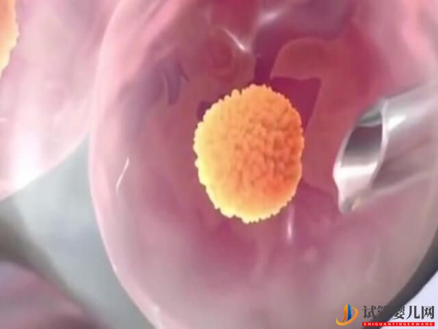 合肥901醫(yī)院試管移植一次大概需要準(zhǔn)備多少錢?(圖2) 合肥901醫(yī)院試管移植一次大概需要準(zhǔn)備多少錢?(圖2)