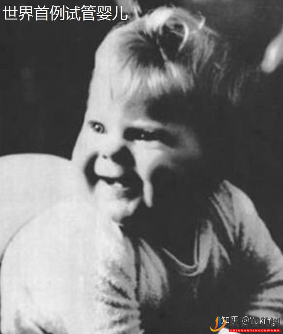 試管嬰兒科普系列一什么是一代、二代、三代試管嬰兒(試管嬰兒費用大概要多少錢)(圖3) 試管嬰兒科普系列一什么是一代、二代、三代試管嬰兒(圖2)