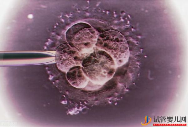 日本人工授精多少錢?(圖2) 日本人工授精多少錢?(圖2)