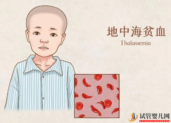 地中海貧血不影響試管成功率(圖1)