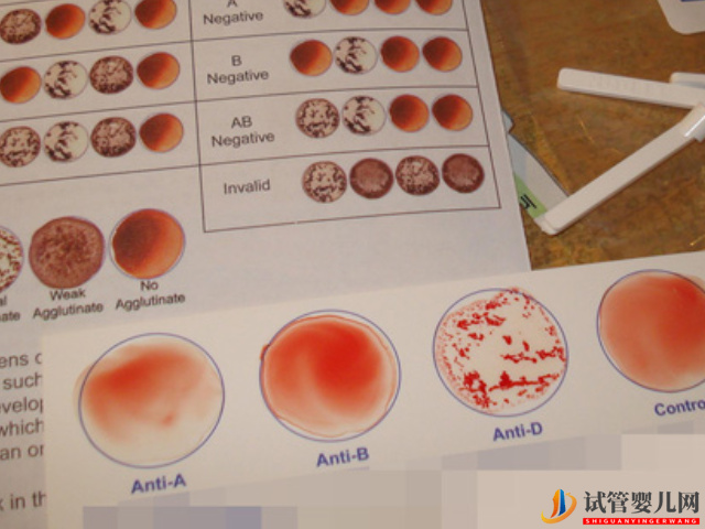 父母與子女血型對照表詳解(圖1)