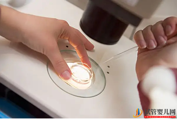 蕁麻疹最好不要直接做試管,對(duì)胚胎著床有這些影響(圖2) 蕁麻疹最好不要直接做試管,對(duì)胚胎著床有這些影響(圖2)