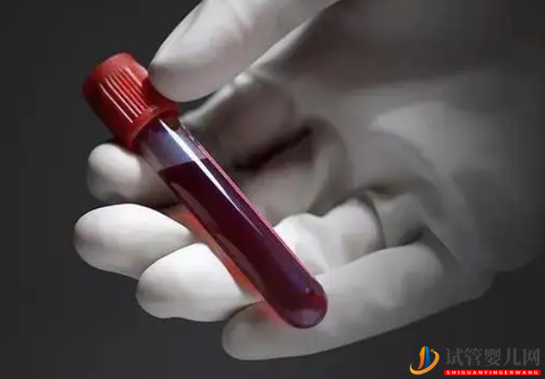 試管前檢查免疫風濕有原因，這5種情況下不可大意(圖2)