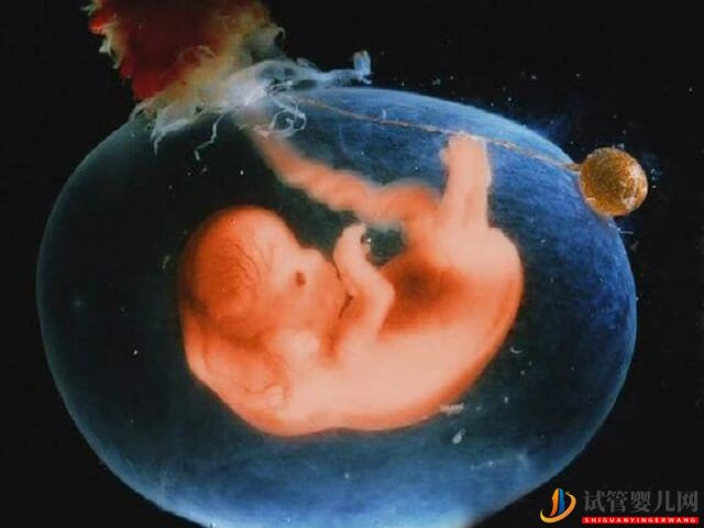 試管嬰兒宮外孕早期的征兆有哪些?(圖1) 試管嬰兒宮外孕早期的征兆有哪些?(圖1)