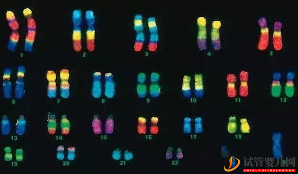 試管查染色體的原因無(wú)非就這幾點(diǎn)(圖1) 試管查染色體的原因無(wú)非就這幾點(diǎn)(圖1)