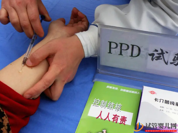 試管做結核菌測試的必要性(圖1)