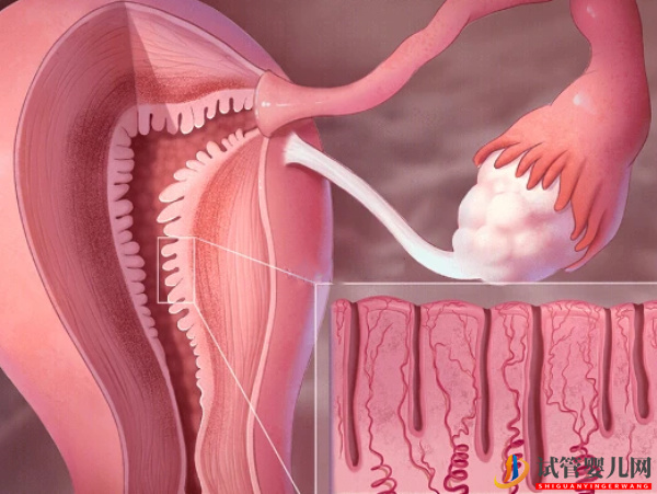 子宮內(nèi)膜厚對試管的影響別忽視,要不要刮宮?(圖1) 子宮內(nèi)膜厚對試管的影響別忽視,要不要刮宮?(圖1)
