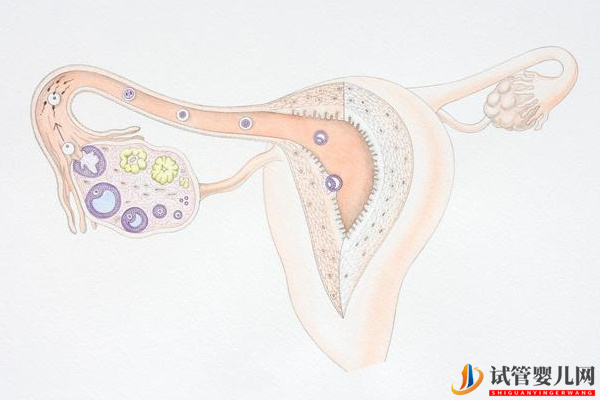 輸卵管通而不暢想做試管得先做手術(圖2)