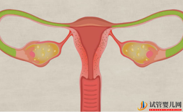 兩側(cè)輸卵管都切除了還能做試管？(圖1)