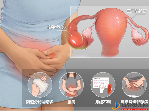 輸卵管積水做試管有明顯影響，要不要切除有兩種情況(圖1)