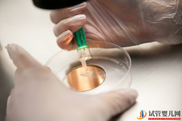 國內精子庫精子做試管費用明細(圖3)