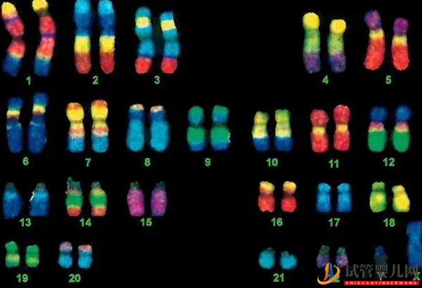 4號染色體異常的后果 - 缺失綜合征、三體重復的原因分析(圖2)