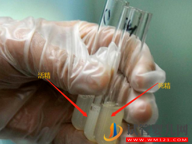 男性死精和活精差異盤點(diǎn),一張圖帶你兩者表面區(qū)別(圖1) 男性死精和活精差異盤點(diǎn),一張圖帶你兩者表面區(qū)別(圖1)